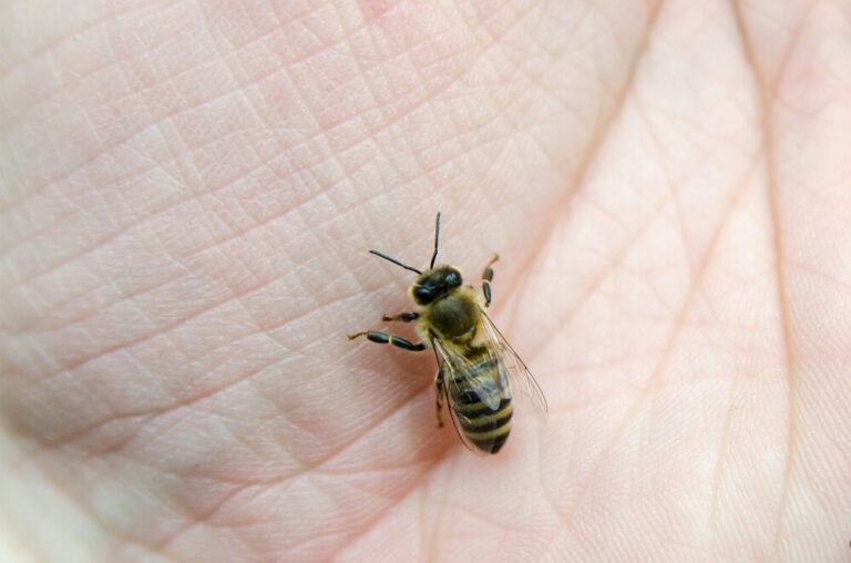 Bee Stinger Stuck Under Skin Here S How To Remove It