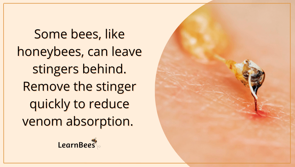 essential oils for bee stings