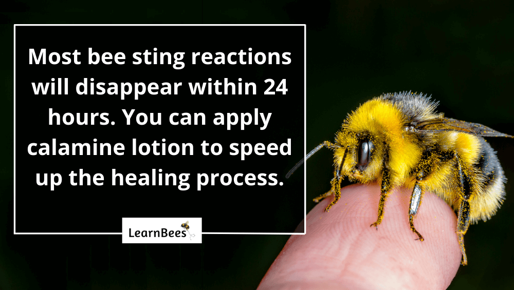 what does a bee sting look like?