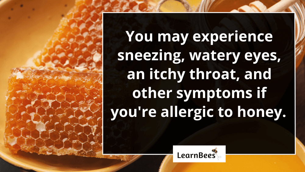 allergic to honey