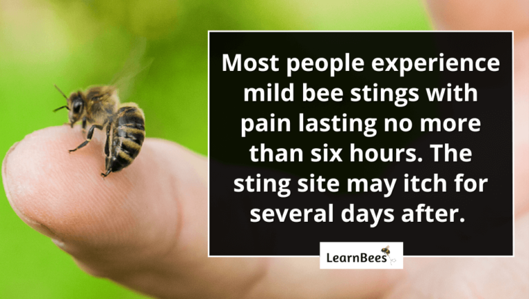 how-long-do-bee-stings-hurt-learnbees