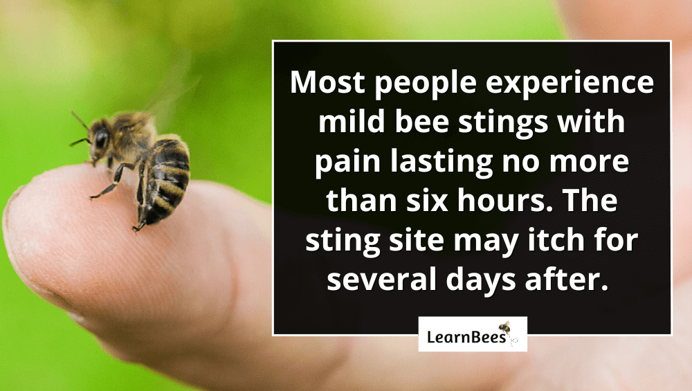 how long do bee stings hurt?